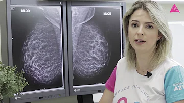 O que é mamografia bilateral para rastreamento?