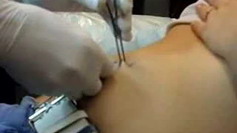 Amanda (ME) getting my belly button peirced!