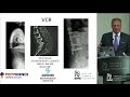 Three Column Osteotomy for Correction of Spinal Deformities - Jens R. Chapman, MD