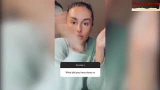 Amber Davies answers questions from fans about her ear surgery