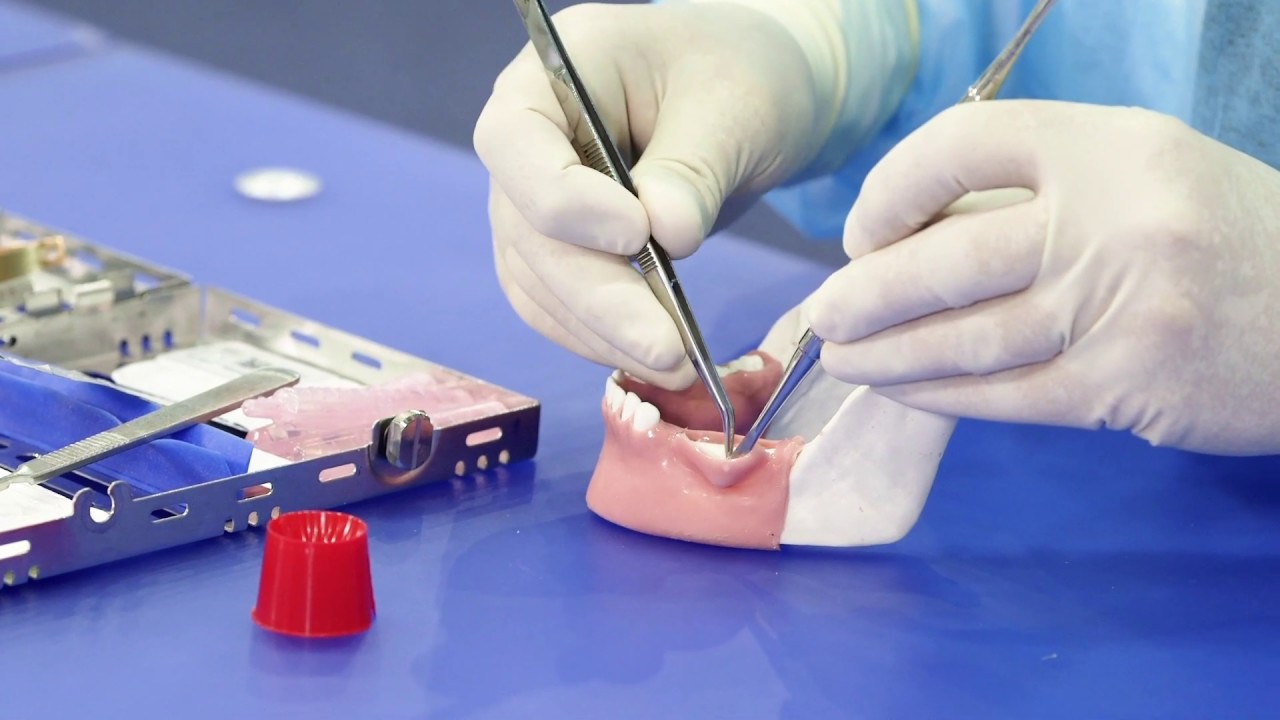 Placing OSSIX® Plus resorbable membrane: Part 1