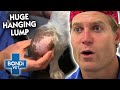 Small Dog has the BIGGEST LUMP Vet has Ever Seen! | Classic Clip | Bondi Vet