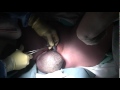 Tegan's Birth