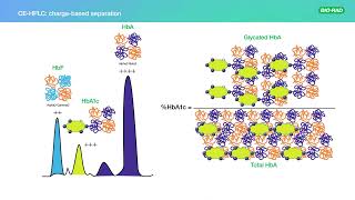 The Impact of Elevated Hemoglobin F (HbF) on HbA1c Results