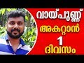 വായ്പ്പുണ്ണ് ഒരു ദിവസം കൊണ്ട് മാറ്റാന്‍|  Mouth Ulcer Home Remedy