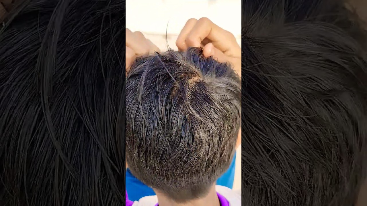 hair growth ke liye alovera gelshorts youtubeshorts ytshort 