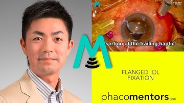 Yamane - Flanged IOL fixation