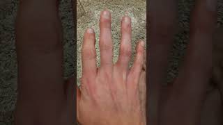 Tremor Finger?
