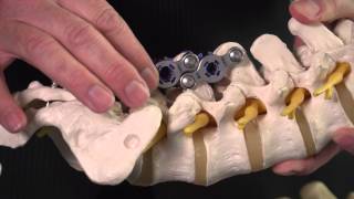 Aurora Spine with an entirely new solution for spinal implant technologies