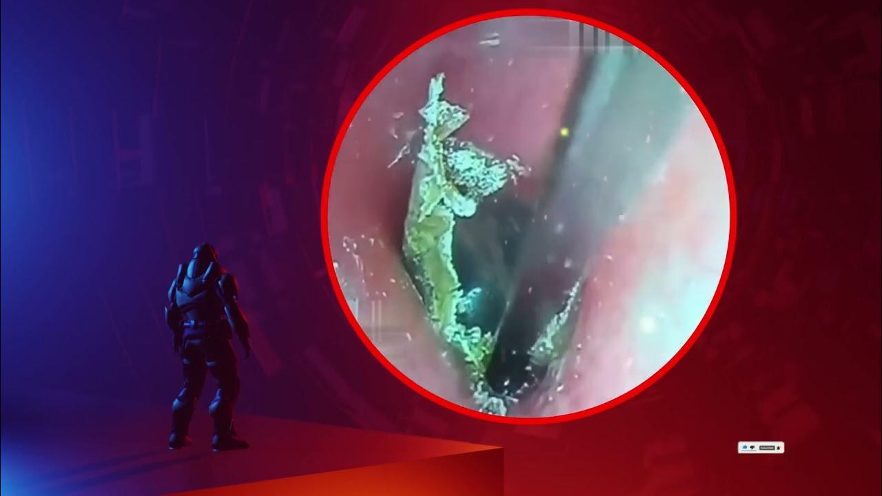 The Truth About earwax Will Shock You. How to remove earwax from ear