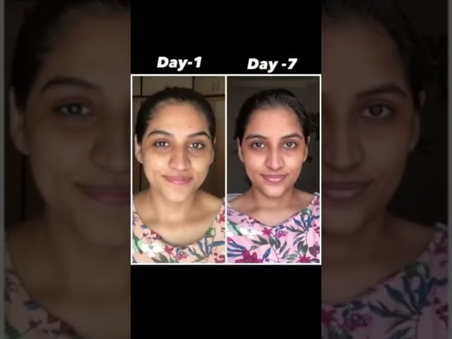 Garnier Vitamin C Serum Review| 3 Day Challenge Review| #shorts #youtubeindia class=