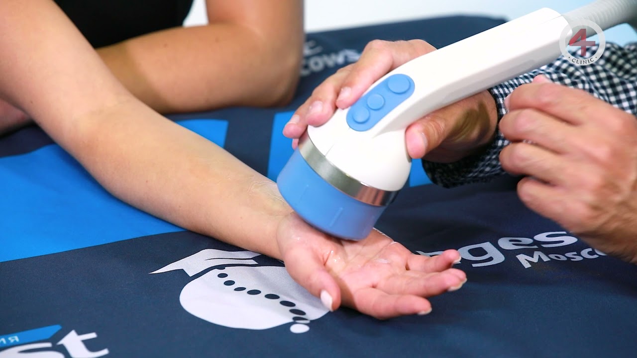 Синдром Карпального канала. - YouTube