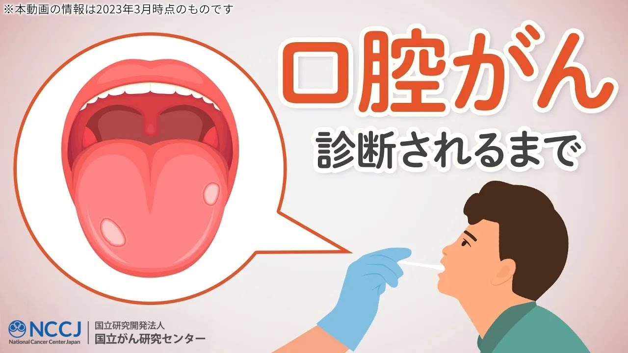 口腔癌 末期症状画像: 口腔底癌 初期 画像 , 口腔癌 画像について – KSOIPY
