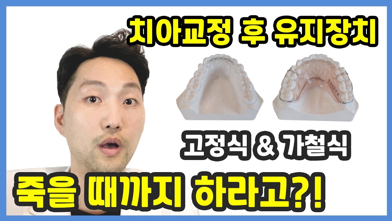치아교정, 교정치료 후 유지장치는 언제까지 해야 하나요???(고정식 & 가철식 유지장치) - Youtube