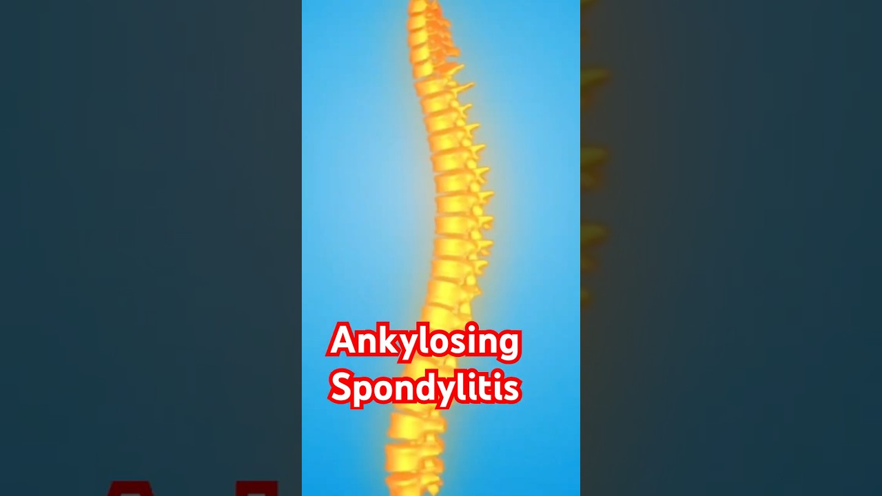 Morning stiffness in young males😩 