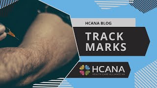 HCANA Blog: Track Marks