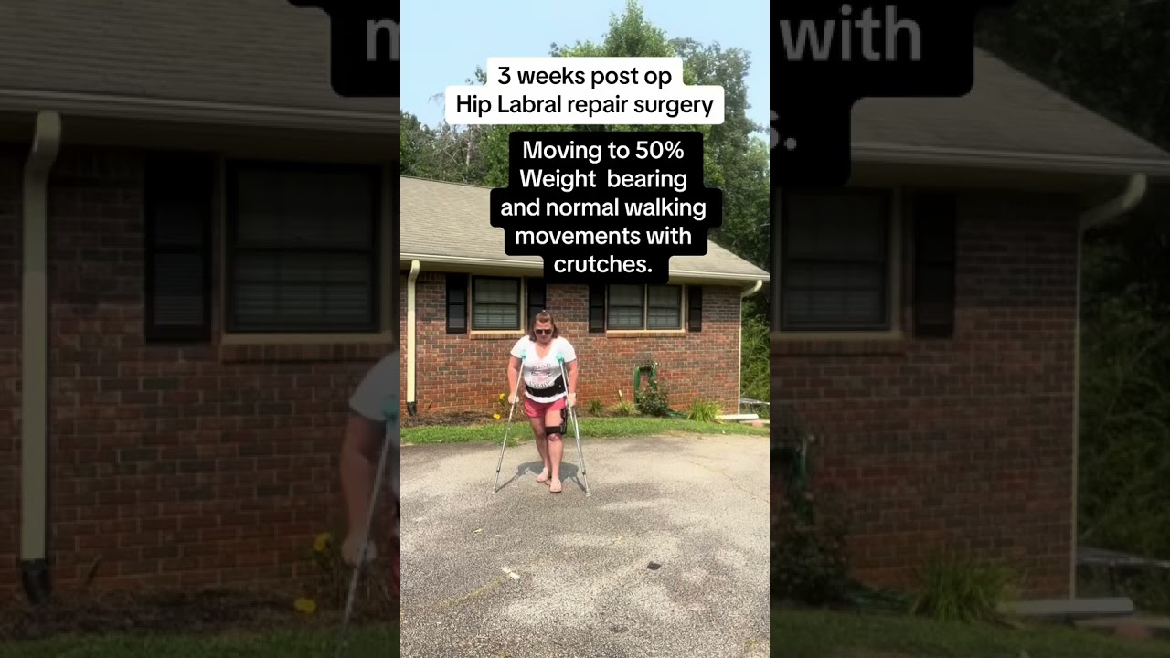 Hip labral tear surgery is a long recovery. 