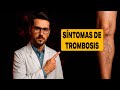 5 Señales de ALERTA Tempranas de Trombosis Que No Debes Ignorar