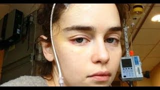 Звезда Игры престолов продемонстрировала последствия операции на мозге Звезда Игры престолов продемонстрировала последствия операции на мозге