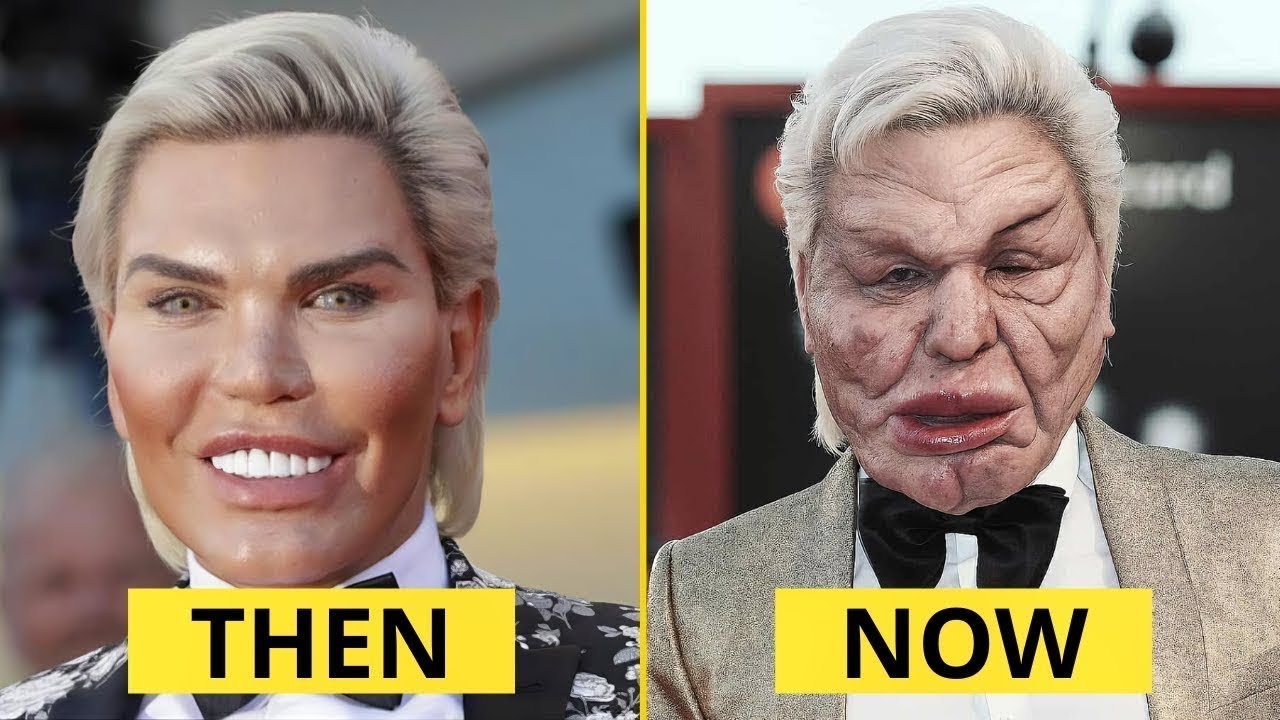 9 Famous Celebrities With the Most Shocking Plastic Surgery