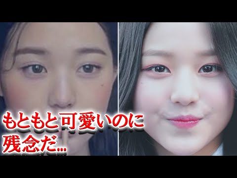 IVEチャン・ウォニョンがファンコミュニティで整形中毒だと言われている理由