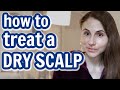 How to treat a DRY, FLAKEY SCALP| Dr Dray