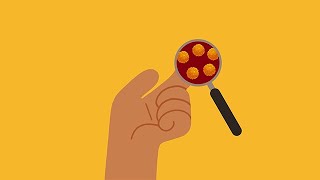 Five Common Questions About Hepatitis C