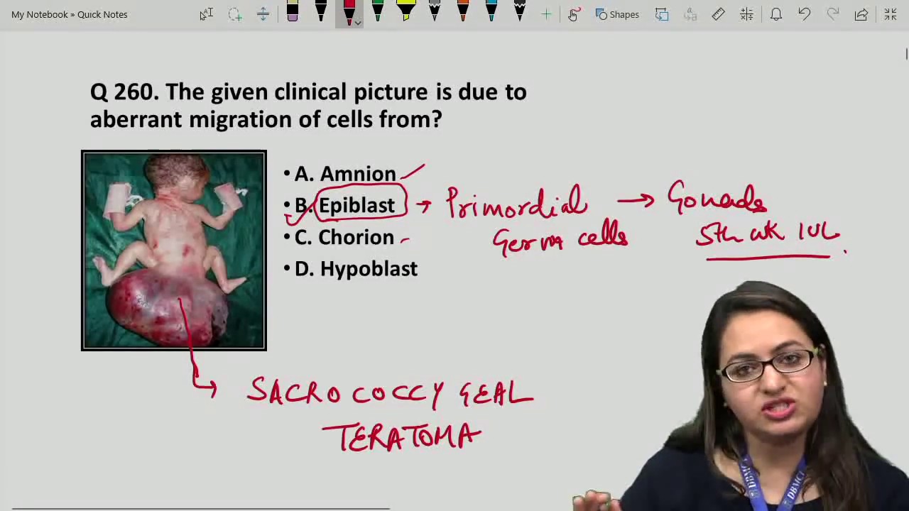 Grand Test March 2019 - 180 (ANATOMY)