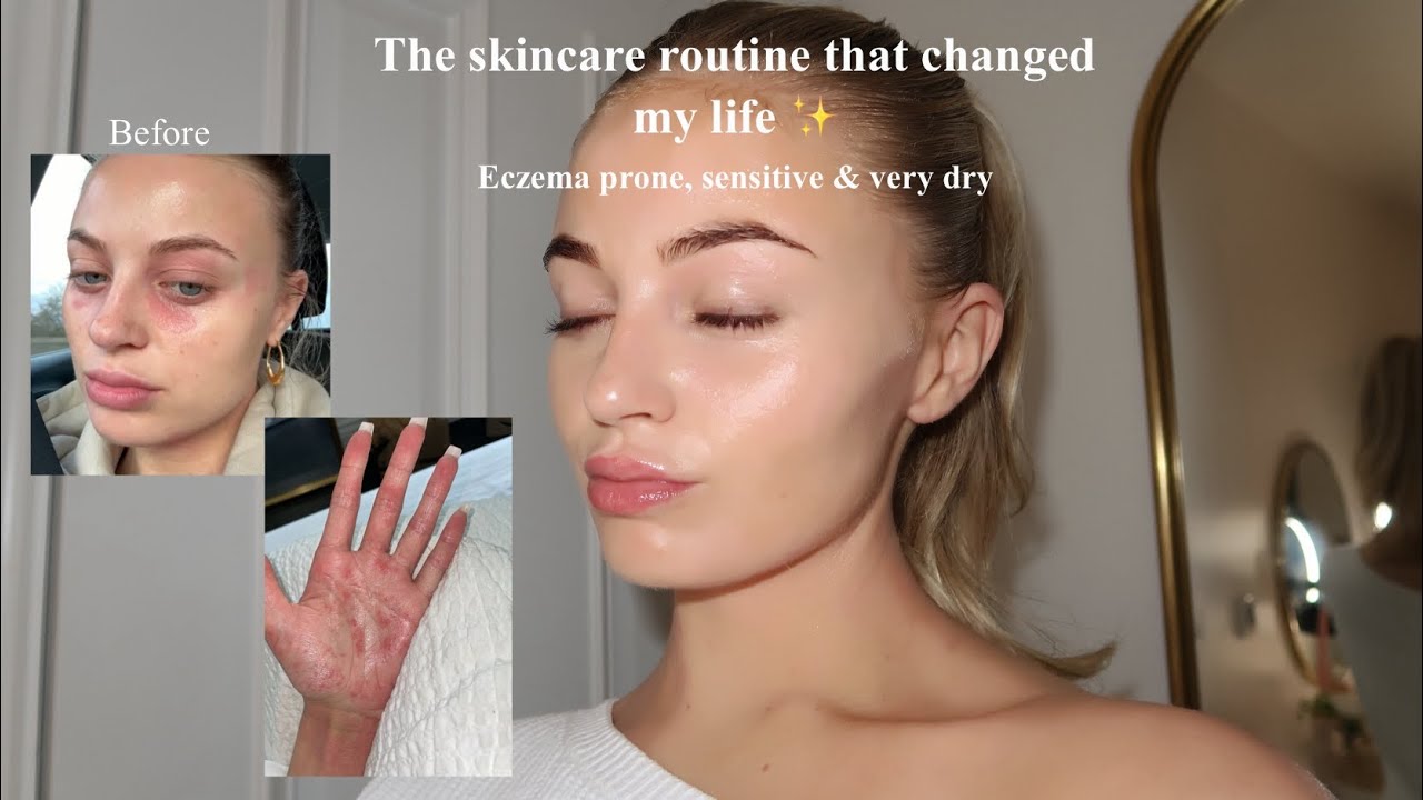 Процедура ухода за кожей, которая ИЗМЕНИЛА мою жизнь | экзема, чувствительная и очень сухая кожа