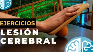 EJERCICIOS PARA LESIÓN CEREBRAL ► FISIOTERAPIA REAL SOLIDARTE NEUROREHABILITACIÓN TRAUMATISMO CRANEO