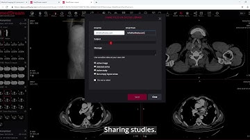 MedDream DICOM Viewer: share the studies