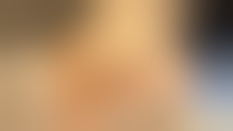 Tarsal Tunnel Release, Deep Peroneal Nerve Decompression