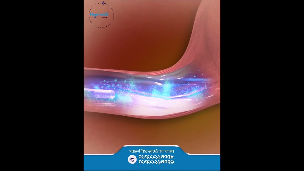 Photo Dynamic Therapy । Heal With Travelley