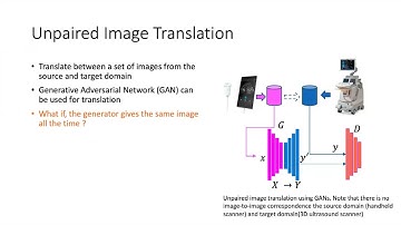 Medical Image Segmentation by AI - Lily Zhou