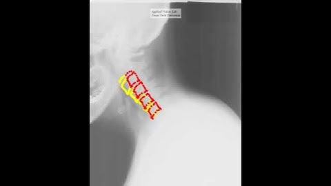 Active Appearance Model