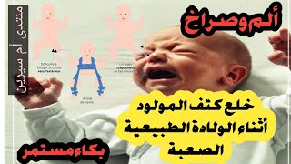 خلع الكتف والفخد ?عند الاطفال حديثي الولادة ? اسبابه وكيفية التعامل مع هذا المشكل