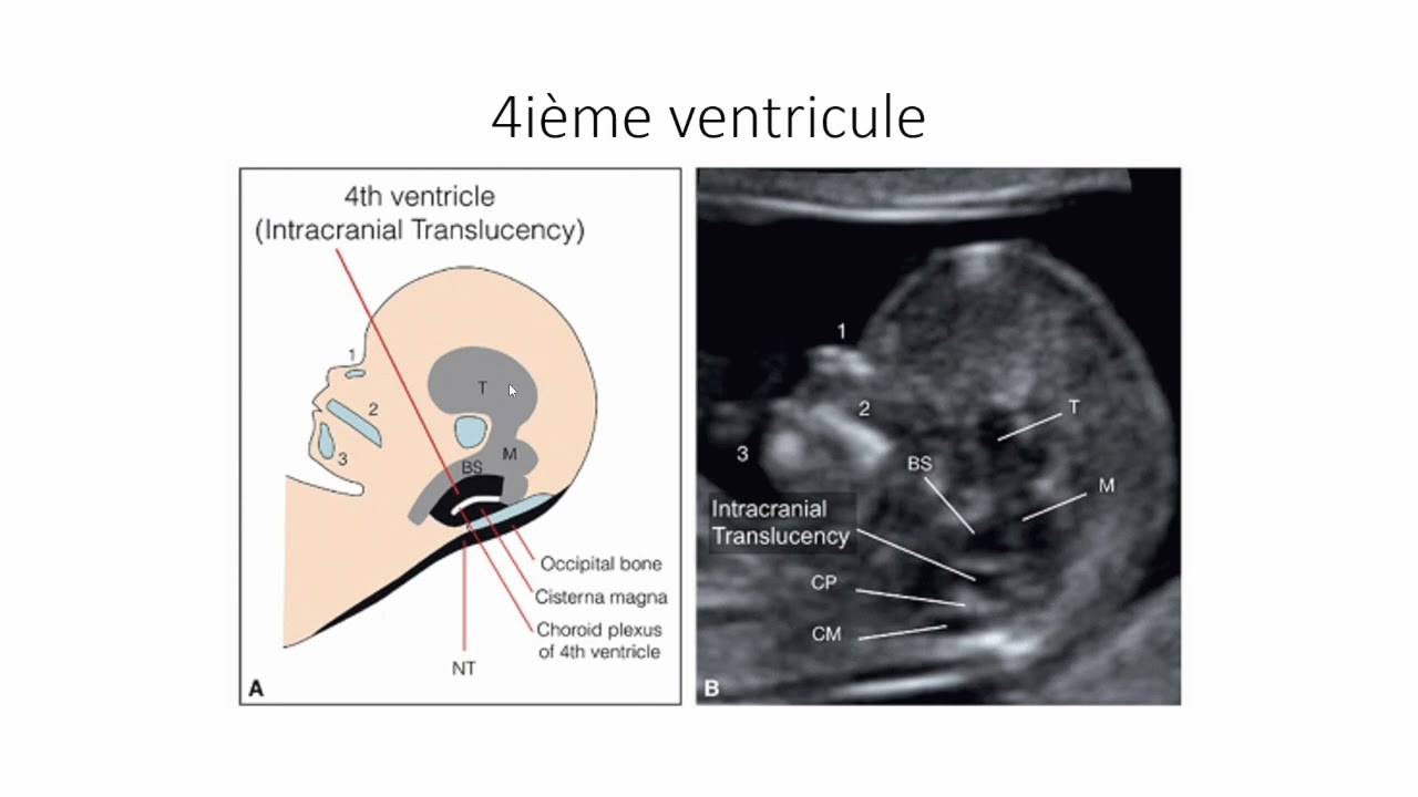 Le Cerveau au 1er trimestre