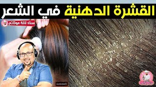 التخلص من القشرة الدهنية في الشعر - الدكتور عماد ميزاب Dr imad mizab