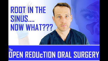 HOW to RETRIEVE a ROOT IN THE MAXILLARY SINUS! DISPLACED ROOT RETRIEVAL TUTORIAL