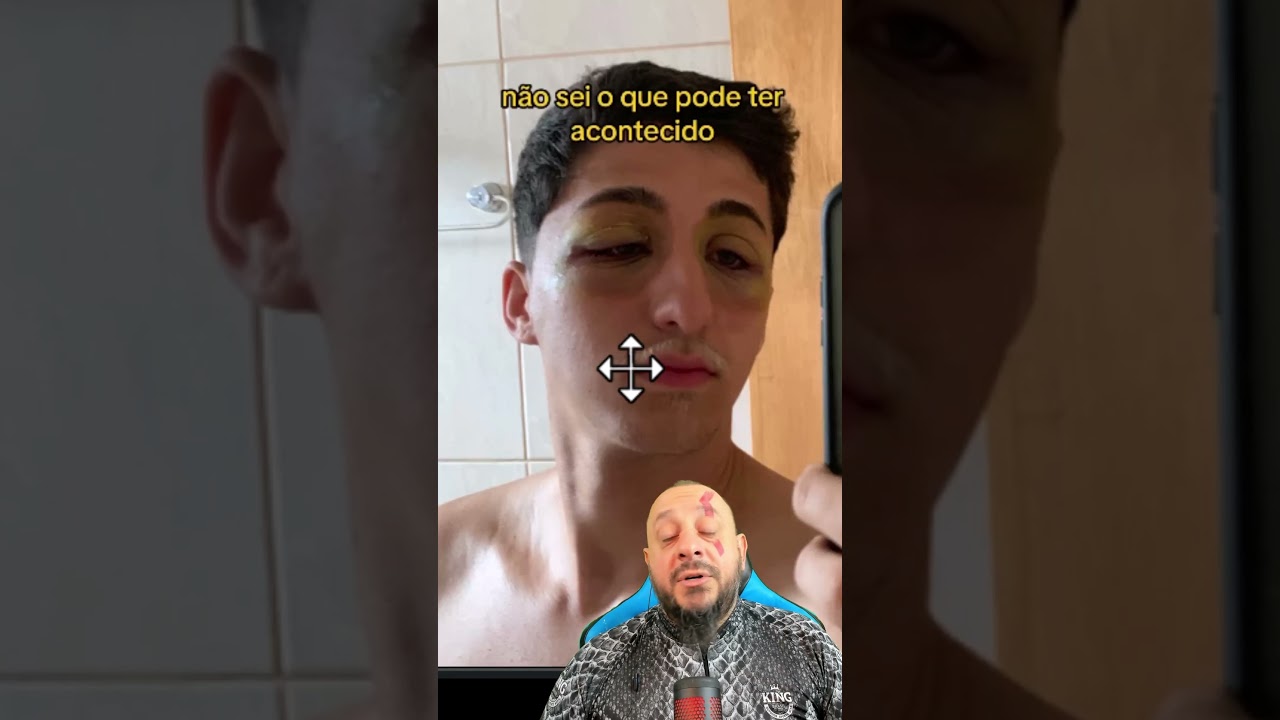 Jovem picado por barata viraliza na internet?