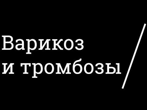 Варикоз и тромбоз. Тромбофлебит тромбоз вен. Профилактика и лечение тромбоза. Причины тромбоза.