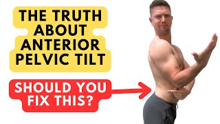 The TRUTH About Fixing Anterior Pelvic Tilt - Is It Worth It?