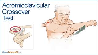 Acromioclavicular Crossover Test - Chiropractic Online CE™