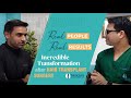 Incredible Transformation after Hair Transplant Surgery | Best Hair Transplant Surgeon in Delhi