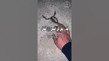 حديث النبي صلى ﷺ لدغة العقرب 