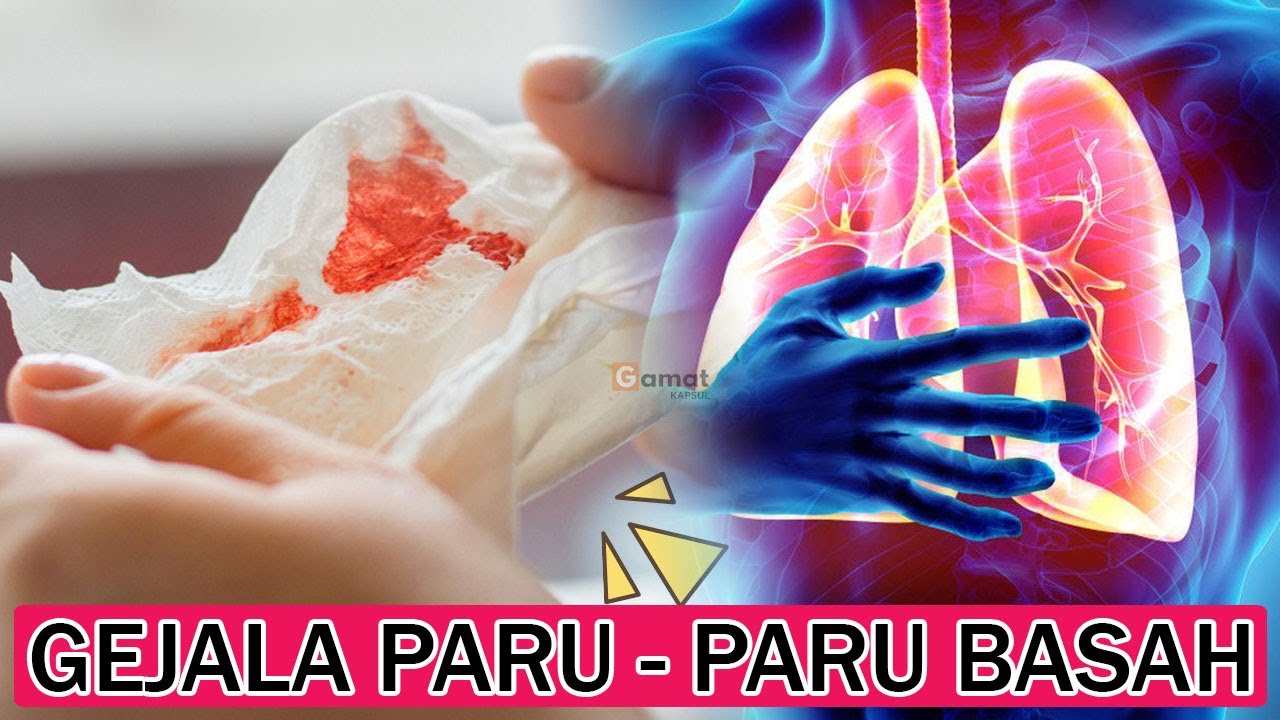 Gejala Dan Cara Mencegah Paru - Paru Basah | Tips Sehat 
