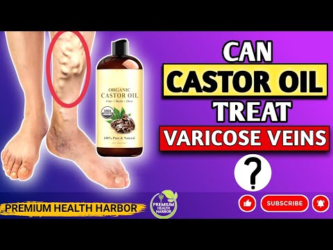 Castor Oil's Trending Treatment for Varicose Veins | Castor Oil for Treating Varicose Veins