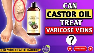 Castor Oil's Trending Treatment for Varicose Veins | Castor Oil for Treating Varicose Veins