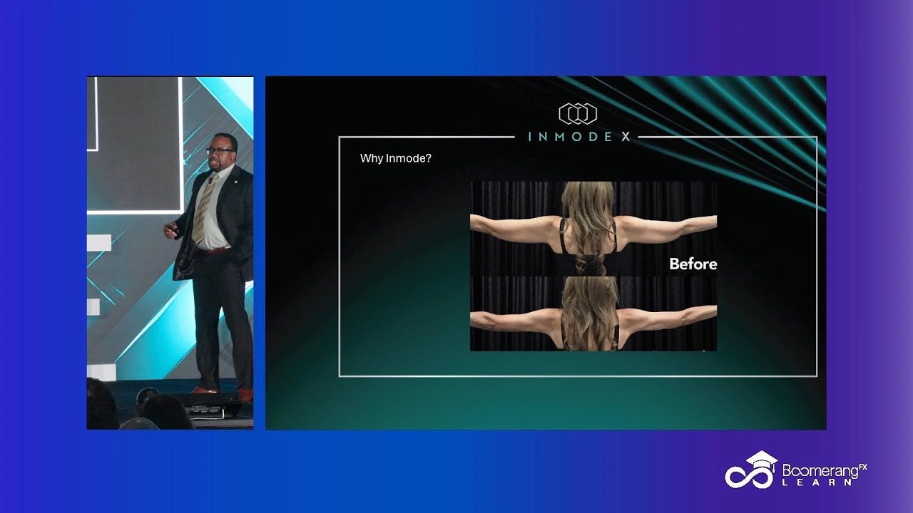 Leveraging InMode Devices For Practice Growth - YouTube