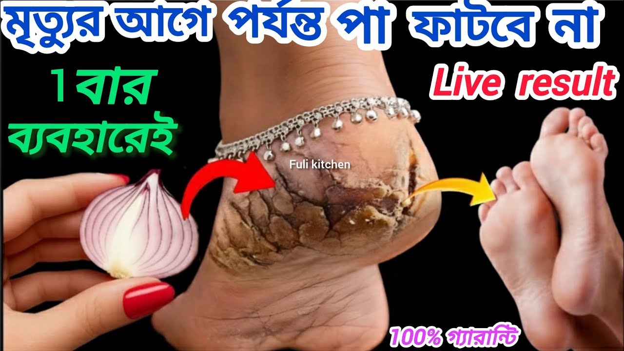 এক রাতে পা ফাটা থেকে মুক্তি পাওয়ার ঘরোয়া পদ্ধতি/cracked heels treatment/ kitchen tips & hack